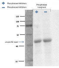 S6K1-2 | Ribosomal-protein S6 kinase homolog 1,2 - phosphorylated in the group Antibodies Plant/Algal / Environmental Stress / Cold stress at Agrisera AB (Antibodies for research) (AS13 2664)